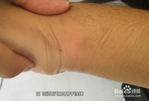 如何使用云南白药气雾剂