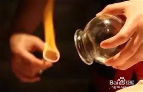 如何正确拔火罐