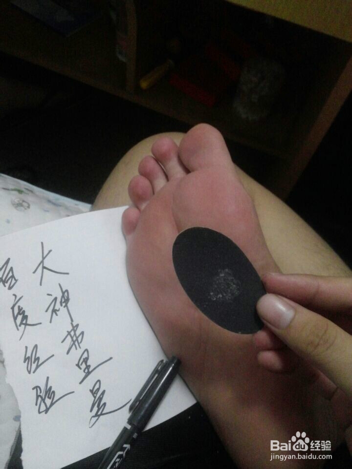 如何去除脚板死皮