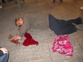 老年人摔倒后该怎么办?