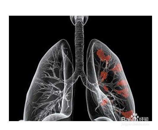 了解抽烟危害,关注身体健康