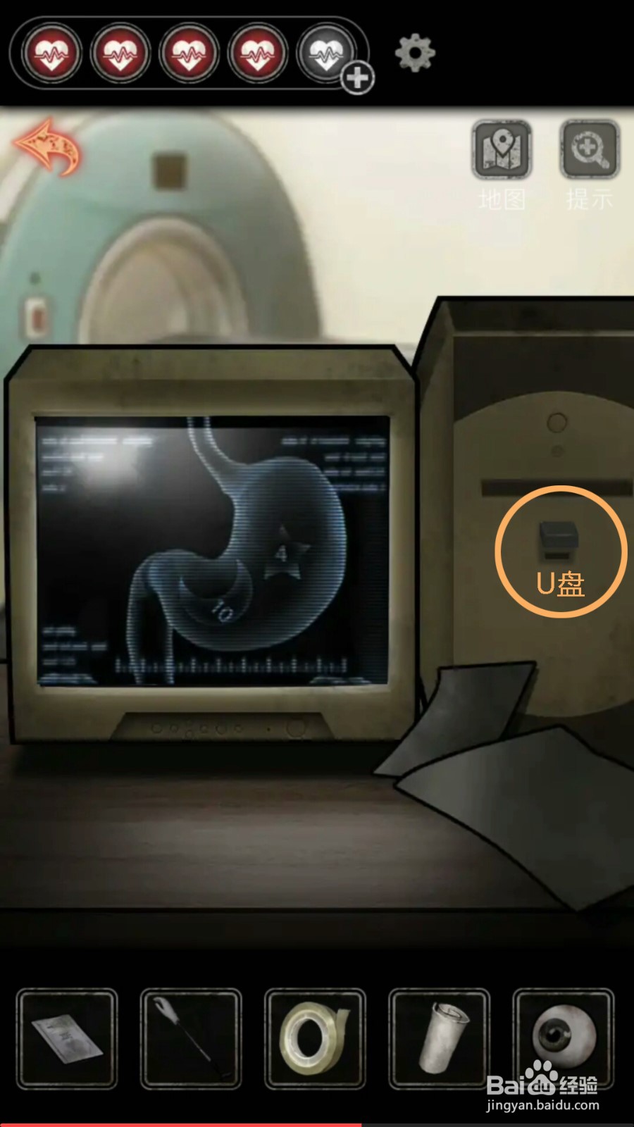 十三号病院第四章攻略