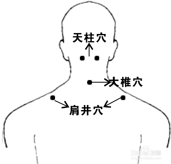 颈椎病治疗方法