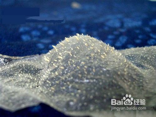 如何去除黑头让鼻子更漂亮