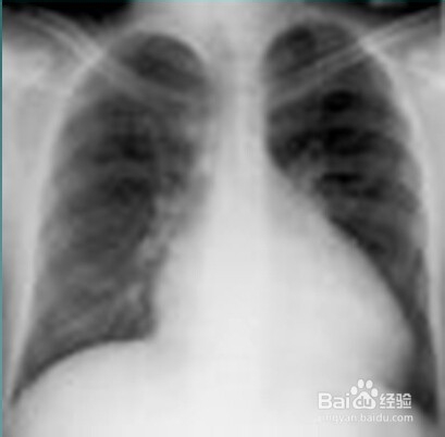 关于心肌疾病的临床图片。