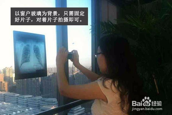 如何用手机拍照医院检查的影像片子