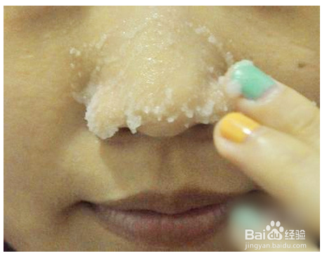 怎么变漂亮------去除黑头偏方大辨别