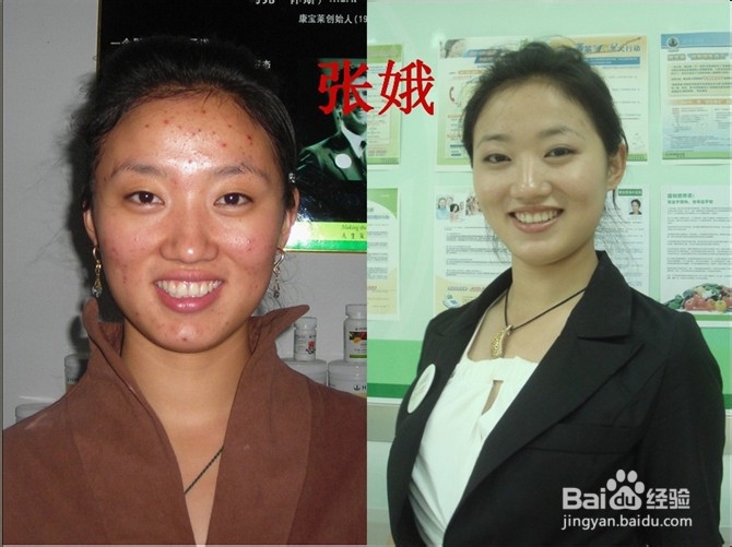 减肥就要健康减肥 先看效果再决定