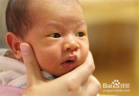 应对宝宝黄疸,妈妈你应该怎么办?