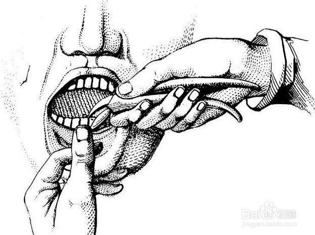 什么时候拔牙是不好的