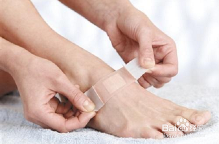 外伤该怎么处理伤口以及注意事项有哪些？