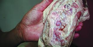 肉类的几个部位千万别吃！