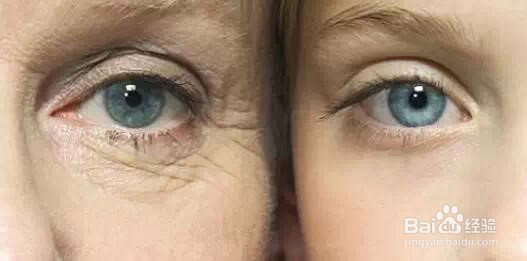 女性眼部的保养与护理