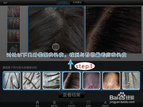 美发通教程之头皮头发诊断新手版