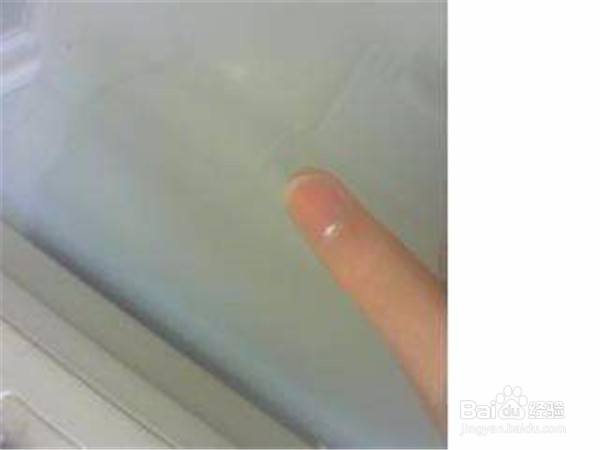 指甲上长白色的斑是怎么一回事?