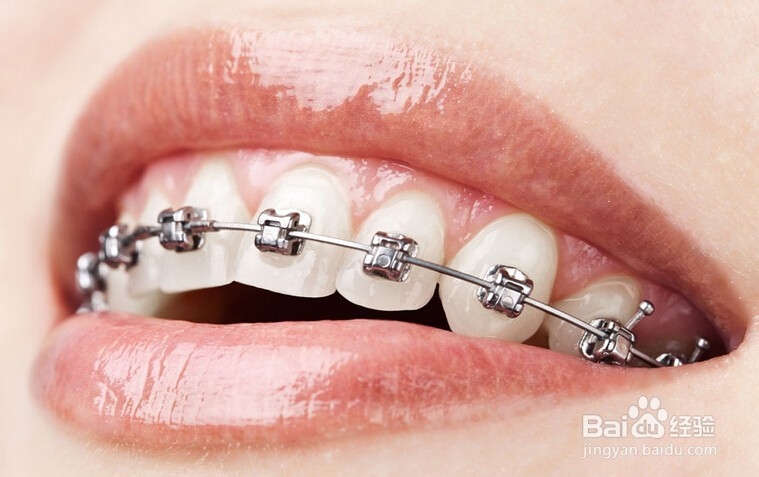 成人龅牙矫正有风险吗?