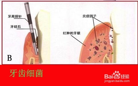 牙膏如何去斑/牙膏能祛雀斑吗
