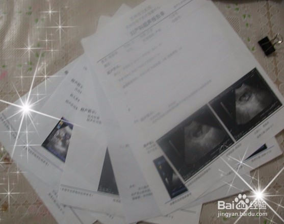 孕妇应该为自己准备待产的八大件