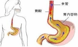 萎缩性胃炎的表现症状?