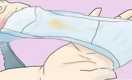 孕妇内裤裆发黄是怎么回事 清洗方法