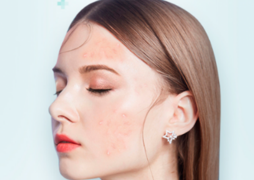 孕妇护肤品成分禁用表