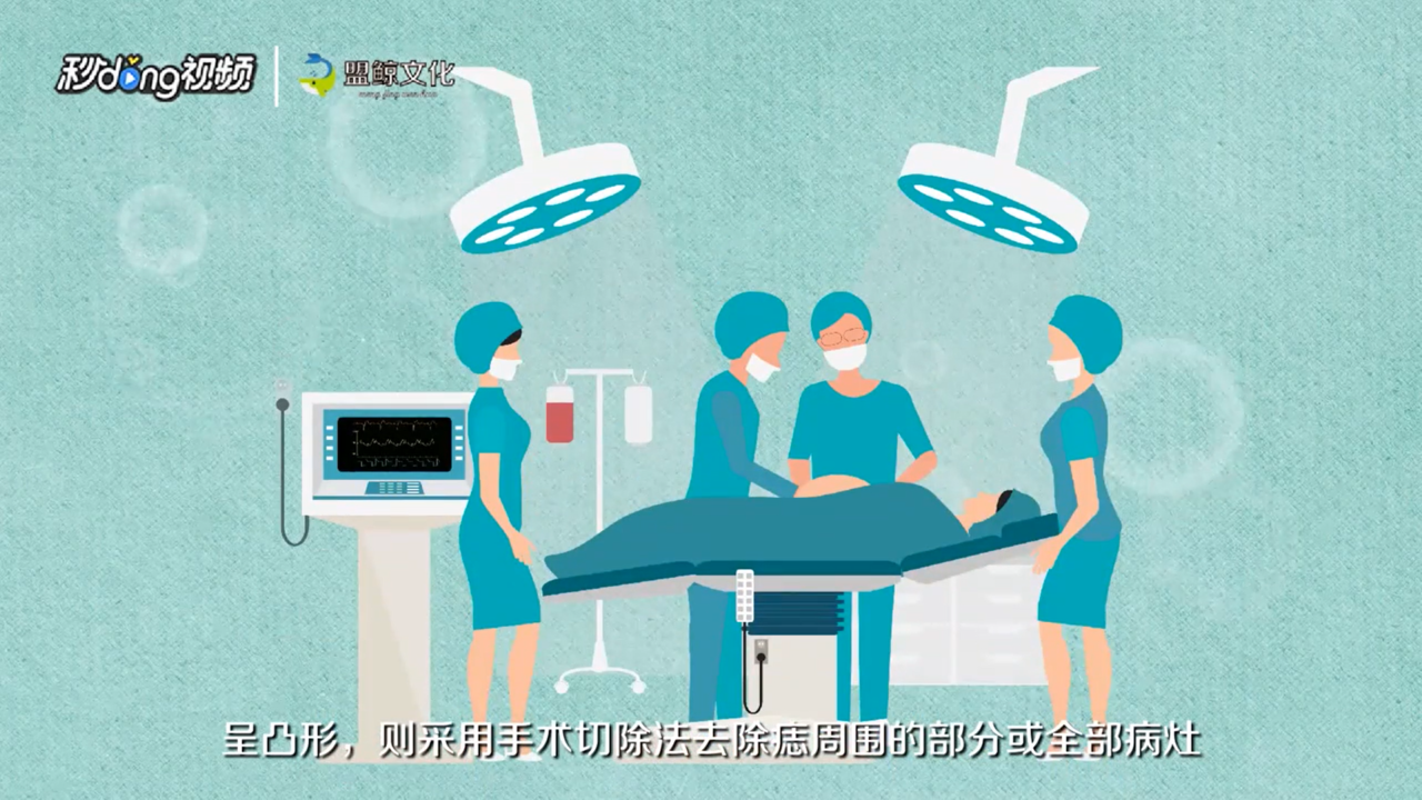 面部去痣有哪些方法