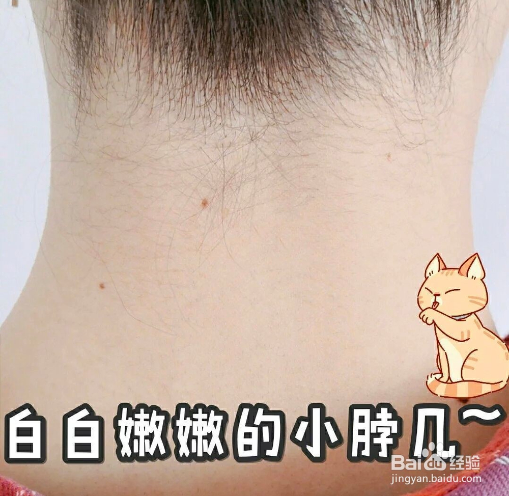 脖子黑怎么变白