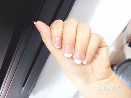 手指甲有点泛白是什么原因