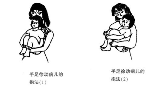 家长该怎么抱脑瘫患儿