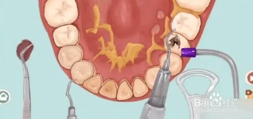 小小收纳唇红齿白通关攻略