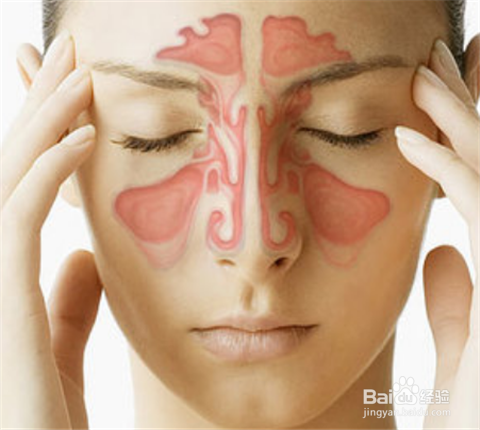 怎样减轻犯鼻炎时的难受？