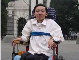 详解重症肌无力的常见症状