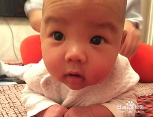 孩子感冒鼻塞怎么办？