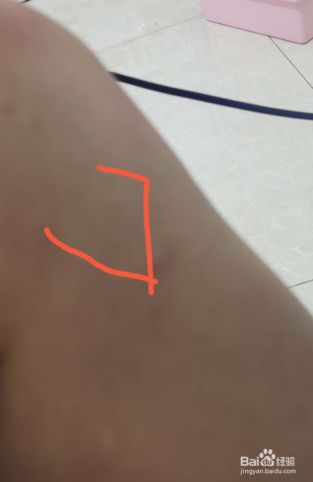 教你如何处理一般暑气。