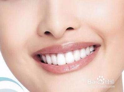 瓷贴面修复后护理