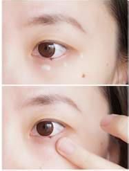 怎样去除黑眼圈,去黑眼圈按摩方法