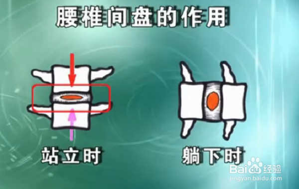 如何维护我们的腰椎