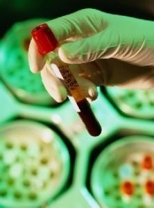 高血压患者哪些项目是必须检查