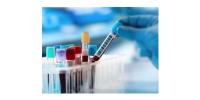 如何早期发现痛风