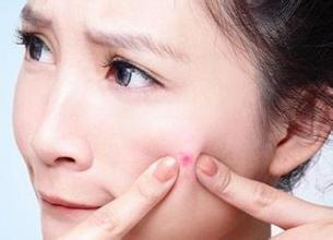 如何护肤，怎么做自然护肤计划，分点战痘更有效