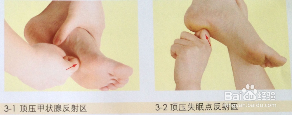 足底按摩治疗失眠