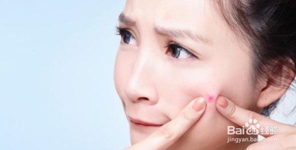 痘痘一直焖在里面怎么办