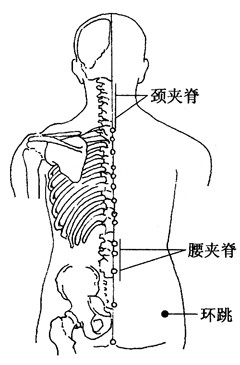 百病刮痧：[55]小儿麻痹后遗症的刮痧疗法