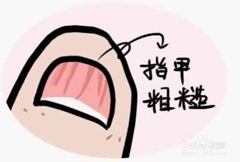 怎么看指甲异常判断宝宝健康状况，以及解决办法