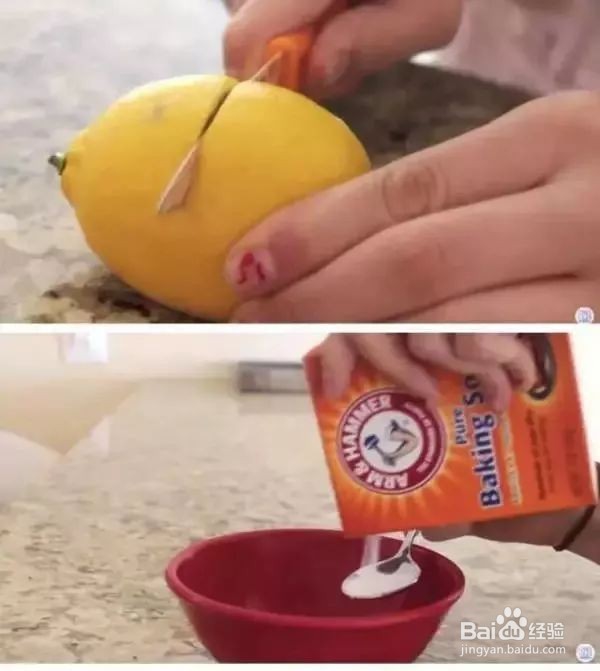 如何消除黄牙,牙齿发黄怎么办
