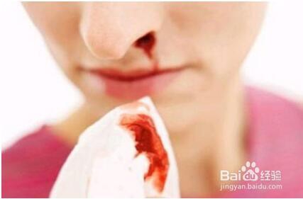 儿童鼻出血怎么处理？
