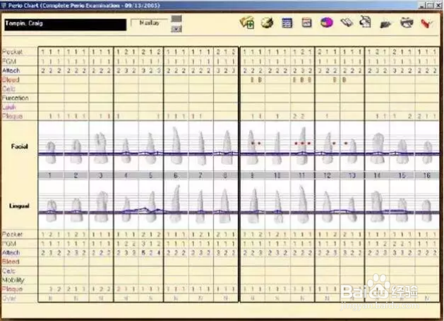 优梨美牙的牙周检查内容