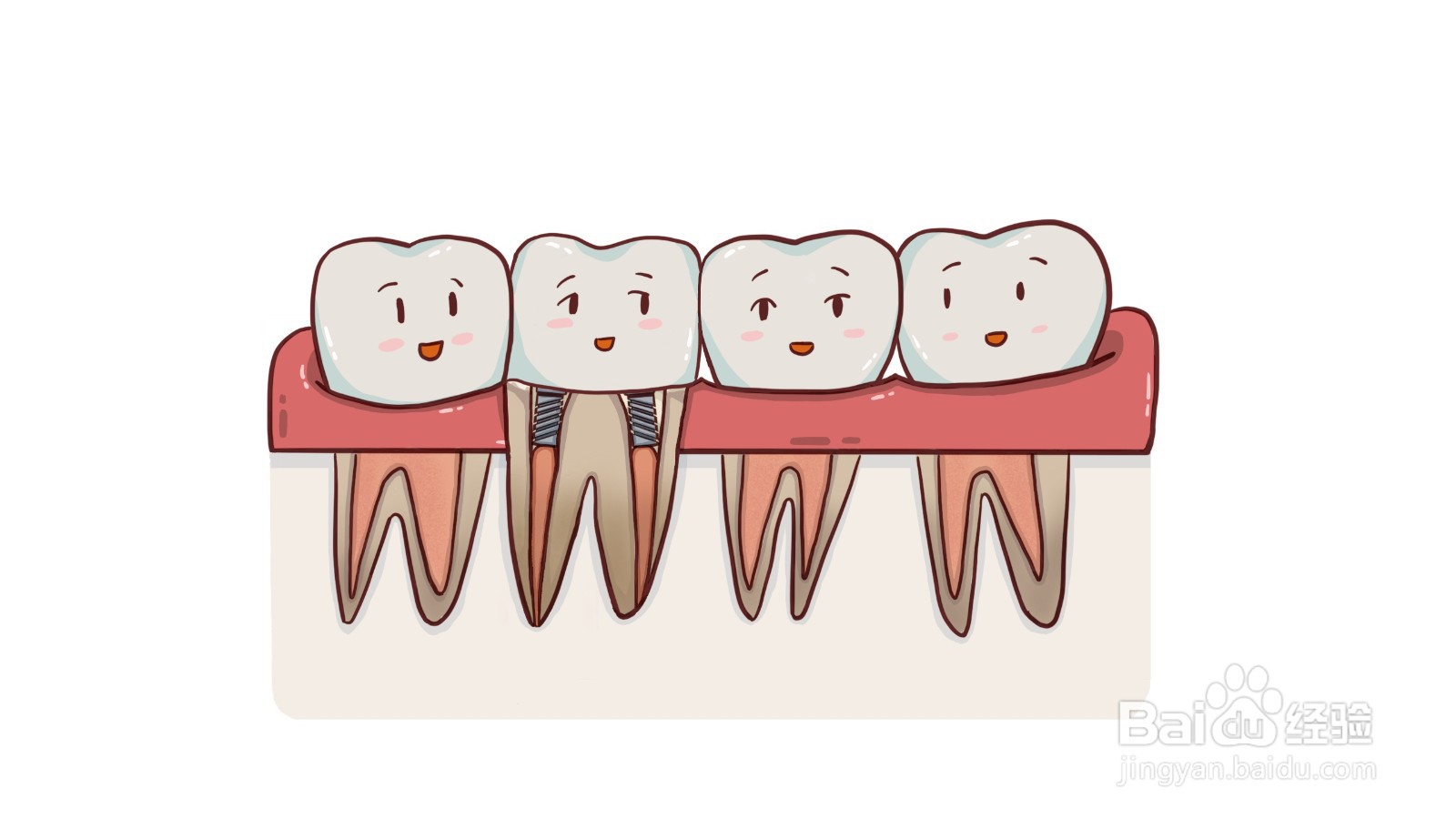 什么是根管治疗？有什么危害？