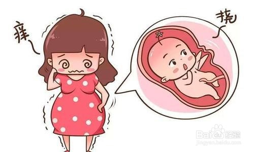 怎么更快更好地缓解孕妇皮肤瘙痒