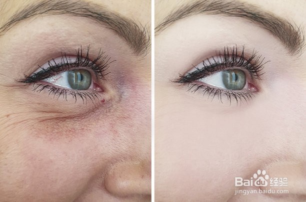 如何改善眼睛疲劳所带来的飞蚊症?